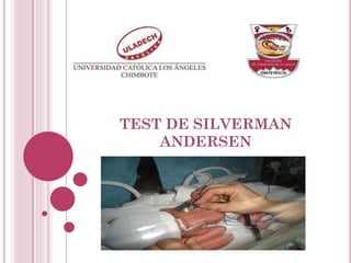 TEST DE SILVERMAN
ANDERSEN
 