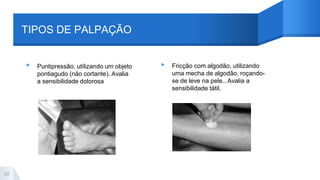 TIPOS DE PALPAÇÃO
▸ Puntipressão, utilizando um objeto
pontiagudo (não cortante). Avalia
a sensibilidade dolorosa
▸ Fricção com algodão, utilizando
uma mecha de algodão, roçando-
se de leve na pele.. Avalia a
sensibilidade tátil.
20
 
