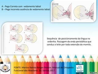 LEVE SEU O BEBÊ AO DENTISTA
FONTE: Marina Batista Borges Pereira. Manual de Ortopedia
Funcional dos Maxilares .Ed. Santos.2017
A - Pega Correta com vedamento labial
B – Pega incorreta ausência de vedamento labial.
Sequência de posicionamento da língua na
ordenha. Passagem da onda peristáltica que
conduz o leite por toda extensão do mamilo.
 
