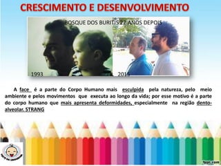 A face é a parte do Corpo Humano mais esculpida pela natureza, pelo meio
ambiente e pelos movimentos que executa ao longo da vida; por esse motivo é a parte
do corpo humano que mais apresenta deformidades, especialmente na região dento-
alveolar. STRANG
 