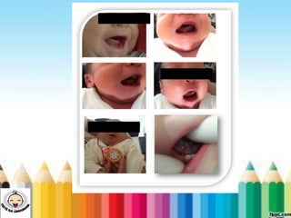 LEVE SEU O BEBÊ AO DENTISTA
 