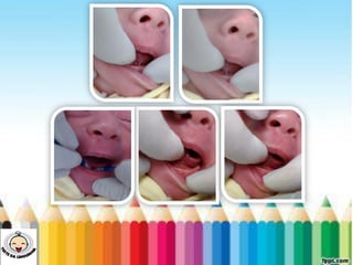 LEVE SEU O
BEBÊ AO
DENTISTA
 