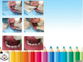 LEVE SEU O BEBÊ AO DENTISTA
 