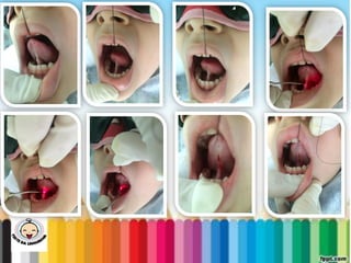 LEVE SEU O BEBÊ AO DENTISTA
 