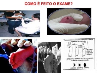 COMO É FEITO O EXAME? 