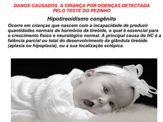 DANOS CAUSADOS  A CRIANÇA POR DOENÇAS DETECTADA PELO TESTE DO PEZINHO Hipotireoidismo congênito Ocorre em crianças que nascem com a incapacidade de produzir quantidades normais de hormônio da tireóide, o qual é essencial para o crescimento físico e neurológico normal. A principal causa do HC é a falência parcial ou total do desenvolvimento da glândula tireóide (aplasia ou hipoplasia), ou a sua localização ectópica.  