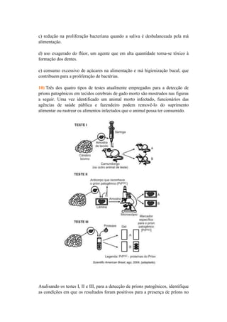 c) redução na proliferação bacteriana quando a saliva é desbalanceada pela má
alimentação.

d) uso exagerado do flúor, um agente que em alta quantidade torna-se tóxico à
formação dos dentes.

e) consumo excessivo de açúcares na alimentação e má higienização bucal, que
contribuem para a proliferação de bactérias.

10) Três dos quatro tipos de testes atualmente empregados para a detecção de
príons patogênicos em tecidos cerebrais de gado morto são mostrados nas figuras
a seguir. Uma vez identificado um animal morto infectado, funcionários das
agências de saúde pública e fazendeiro podem removê-lo do suprimento
alimentar ou rastrear os alimentos infectados que o animal possa ter consumido.




Analisando os testes I, II e III, para a detecção de príons patogênicos, identifique
as condições em que os resultados foram positivos para a presença de príons no
 