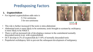 Predisposing Factors 
1. Cryptorchidism 
• For inguinal cryptorchidism odds ratio is 
5.3 for seminoma 
3 for non seminoma 
• This risk is further increased if the testis is intra-abdominal. 
• Abdominal testis is more likely to be seminoma, testis brought to scrotum by orchiopexy 
is more likely to be NSGCT. 
• There is still an increased risk of developing a tumour in the contralateral normally 
descended testicle in pt. with cryptorchidism 
• GCT develop in 2% of cryptorchids & 5-10% of normally descended testis 
• Prepubertal orchidopexy fails to prevent the subsequent development of malignancy 
 