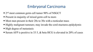 Embryonal Carcinoma 
 2nd most common germ cell tumor 90% of NSGCT 
 Present in majority of mixed germ cell tu mors 
 Most men present in their 20s to 30s with a testicular mass 
 Highly malignant tumours; may invade the cord stuctures.epidydymis 
 High degree of metastasis 
 Serum AFP is positive in 33 5, & beta HCG is elevated in 20% of cases 
 