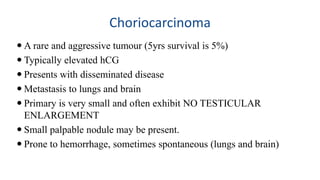 Choriocarcinoma 
 A rare and aggressive tumour (5yrs survival is 5%) 
 Typically elevated hCG 
 Presents with disseminated disease 
 Metastasis to lungs and brain 
 Primary is very small and often exhibit NO TESTICULAR 
ENLARGEMENT 
 Small palpable nodule may be present. 
 Prone to hemorrhage, sometimes spontaneous (lungs and brain) 
 