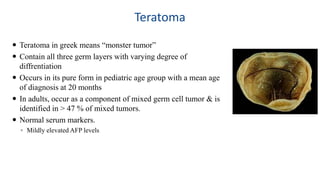 Teratoma 
 Teratoma in greek means “monster tumor” 
 Contain all three germ layers with varying degree of 
diffrentiation 
 Occurs in its pure form in pediatric age group with a mean age 
of diagnosis at 20 months 
 In adults, occur as a component of mixed germ cell tumor & is 
identified in > 47 % of mixed tumors. 
 Normal serum markers. 
◦ Mildly elevated AFP levels 
 