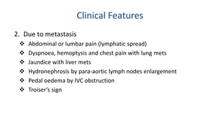 Clinical Features 
2. Due to metastasis 
 Abdominal or lumbar pain (lymphatic spread) 
 Dyspnoea, hemoptysis and chest pain with lung mets 
 Jaundice with liver mets 
 Hydronephrosis by para-aortic lymph nodes enlargement 
 Pedal oedema by IVC obstruction 
 Troiser’s sign 
 
