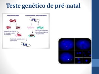 Teste genético de pré-natal
 