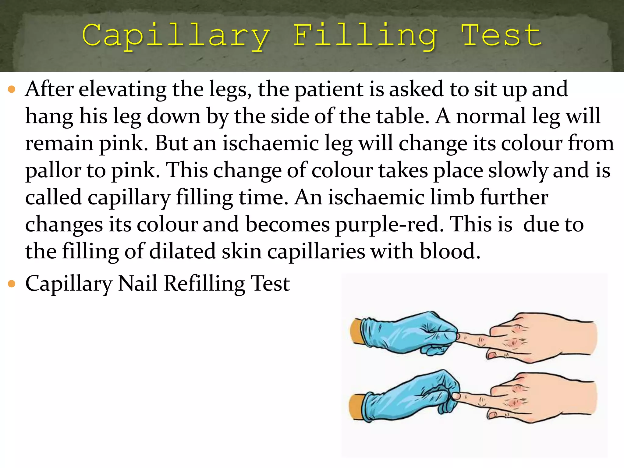  After elevating the legs, the patient is asked to sit up and
hang his leg down by the side of the table. A normal leg will
remain pink. But an ischaemic leg will change its colour from
pallor to pink. This change of colour takes place slowly and is
called capillary filling time. An ischaemic limb further
changes its colour and becomes purple-red. This is due to
the filling of dilated skin capillaries with blood.
 Capillary Nail Refilling Test
 
