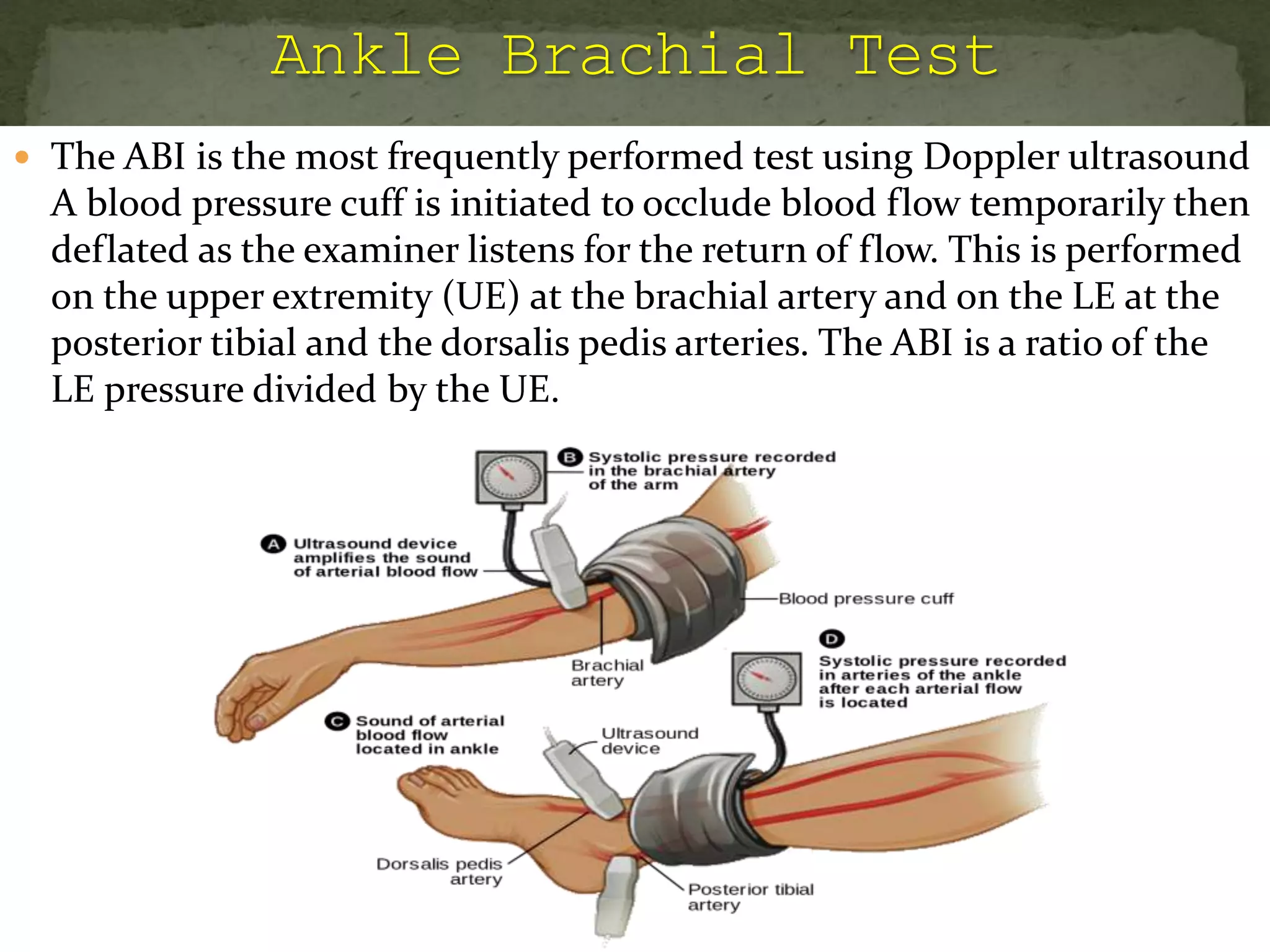  The ABI is the most frequently performed test using Doppler ultrasound
A blood pressure cuff is initiated to occlude blood flow temporarily then
deflated as the examiner listens for the return of flow. This is performed
on the upper extremity (UE) at the brachial artery and on the LE at the
posterior tibial and the dorsalis pedis arteries. The ABI is a ratio of the
LE pressure divided by the UE.
 