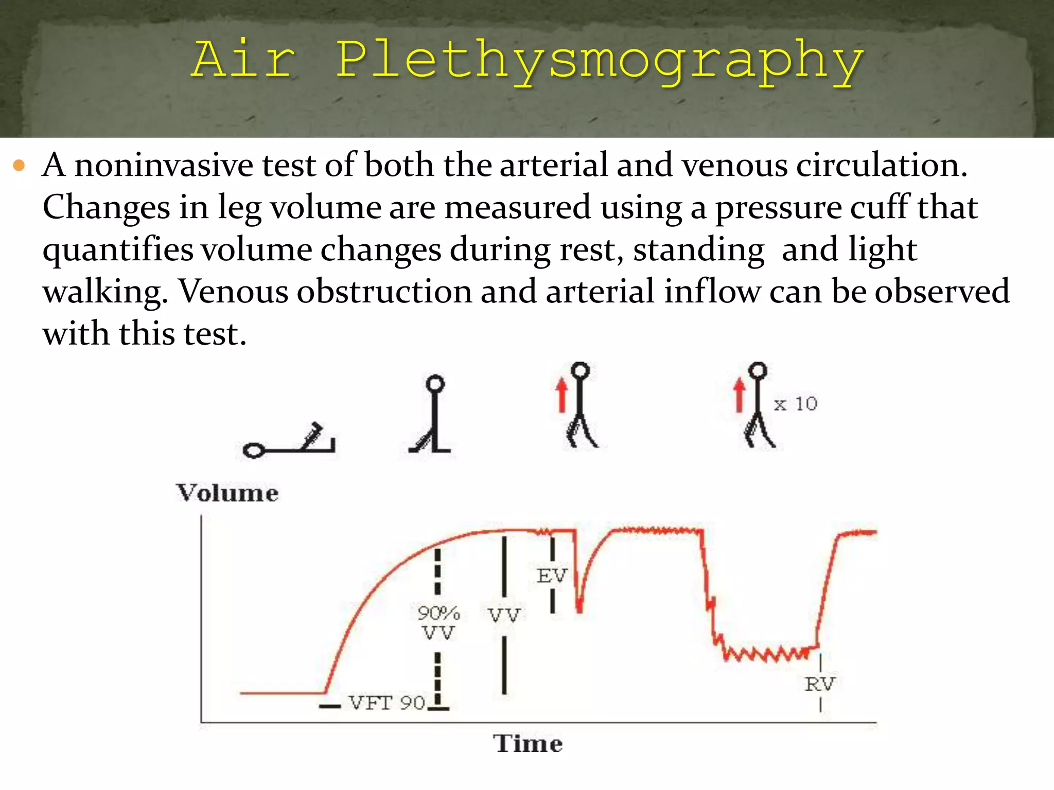  A noninvasive test of both the arterial and venous circulation.
Changes in leg volume are measured using a pressure cuff that
quantifies volume changes during rest, standing and light
walking. Venous obstruction and arterial inflow can be observed
with this test.
 