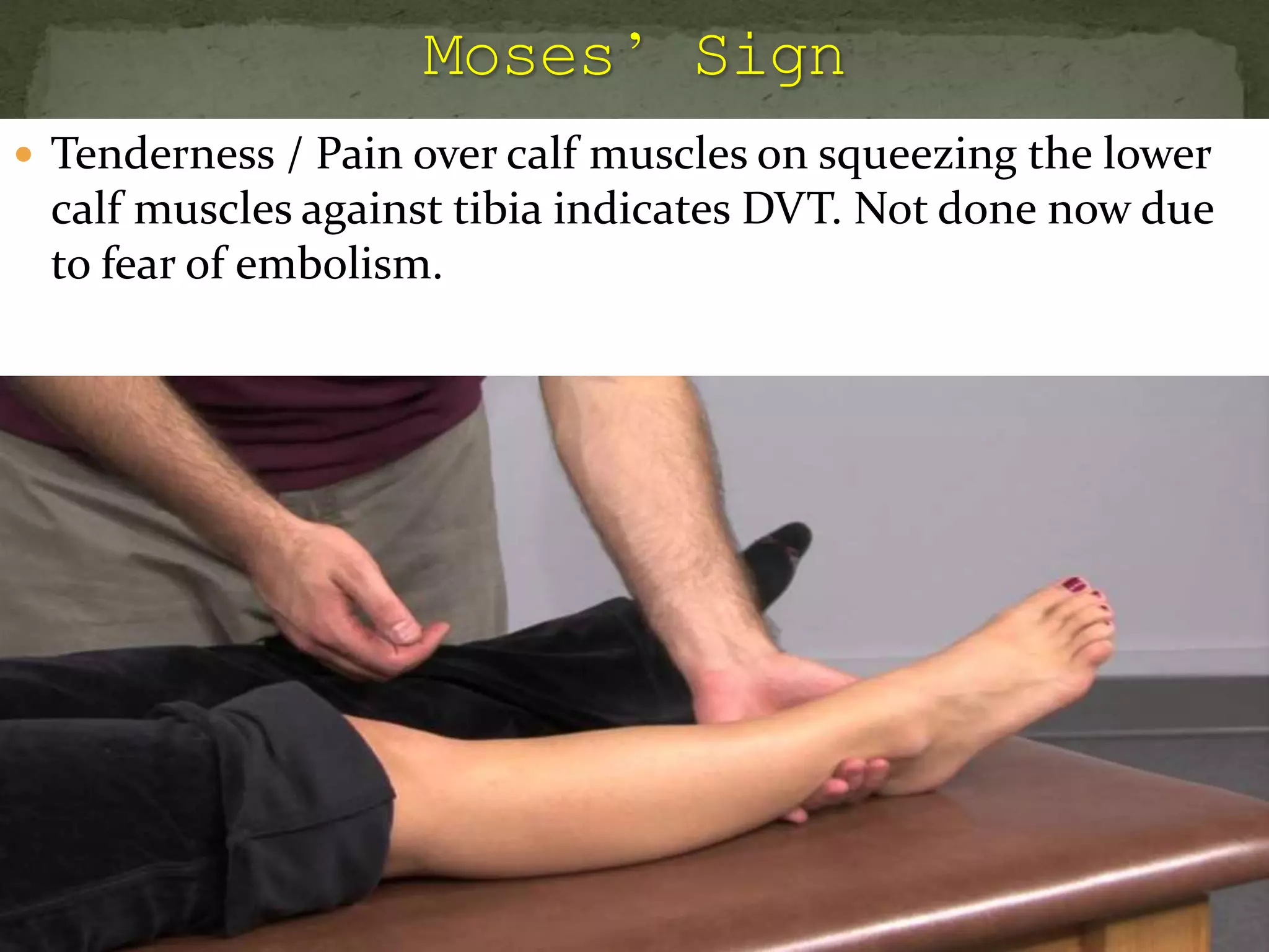  Tenderness / Pain over calf muscles on squeezing the lower
calf muscles against tibia indicates DVT. Not done now due
to fear of embolism.
 