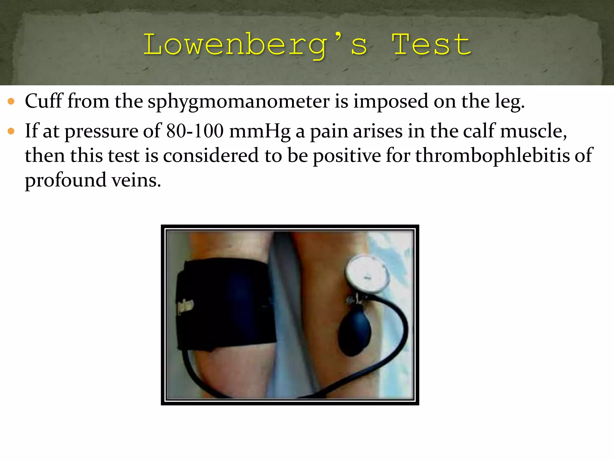  Cuff from the sphygmomanometer is imposed on the leg.
 If at pressure of 80-100 mmHg a pain arises in the calf muscle,
then this test is considered to be positive for thrombophlebitis of
profound veins.
 
