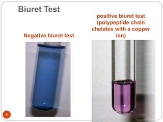 Biuret Test
Negative biuret test
positive biuret test
(polypeptide chain
chelates with a copper
ion)
9
 