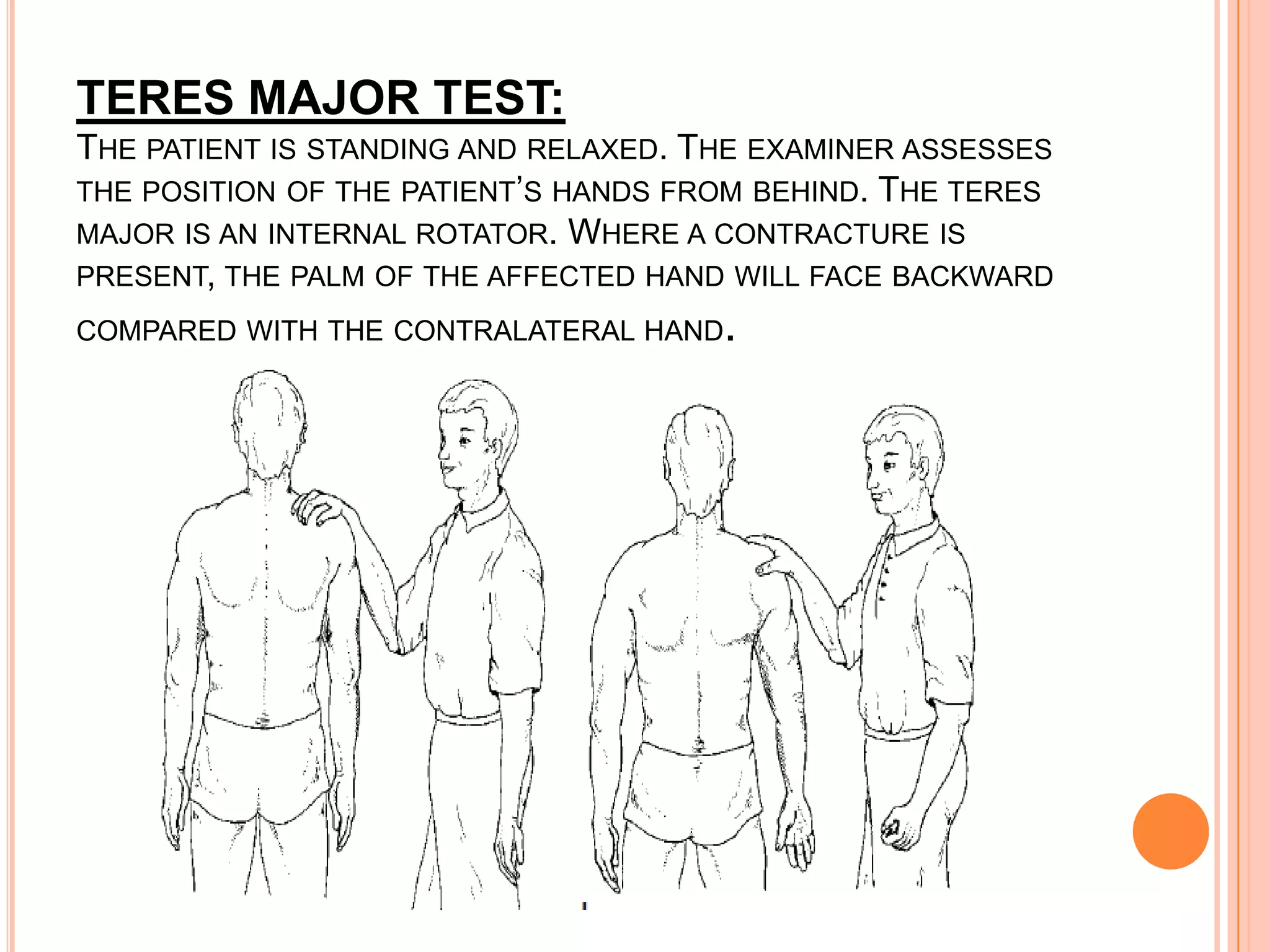 TERES MAJOR TEST:
THE PATIENT IS STANDING AND RELAXED. THE EXAMINER ASSESSES
THE POSITION OF THE PATIENT’S HANDS FROM BEHIND. THE TERES
MAJOR IS AN INTERNAL ROTATOR. WHERE A CONTRACTURE IS
PRESENT, THE PALM OF THE AFFECTED HAND WILL FACE BACKWARD
COMPARED WITH THE CONTRALATERAL HAND  .
 
