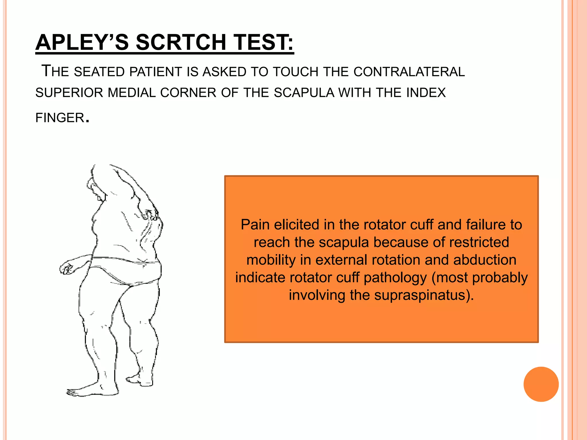 APLEY’S SCRTCH TEST:
THE SEATED PATIENT IS ASKED TO TOUCH THE CONTRALATERAL
SUPERIOR MEDIAL CORNER OF THE SCAPULA WITH THE INDEX
FINGER   .



                          Pain elicited in the rotator cuff and failure to
                            reach the scapula because of restricted
                           mobility in external rotation and abduction
                         indicate rotator cuff pathology (most probably
                                  involving the supraspinatus).
 
