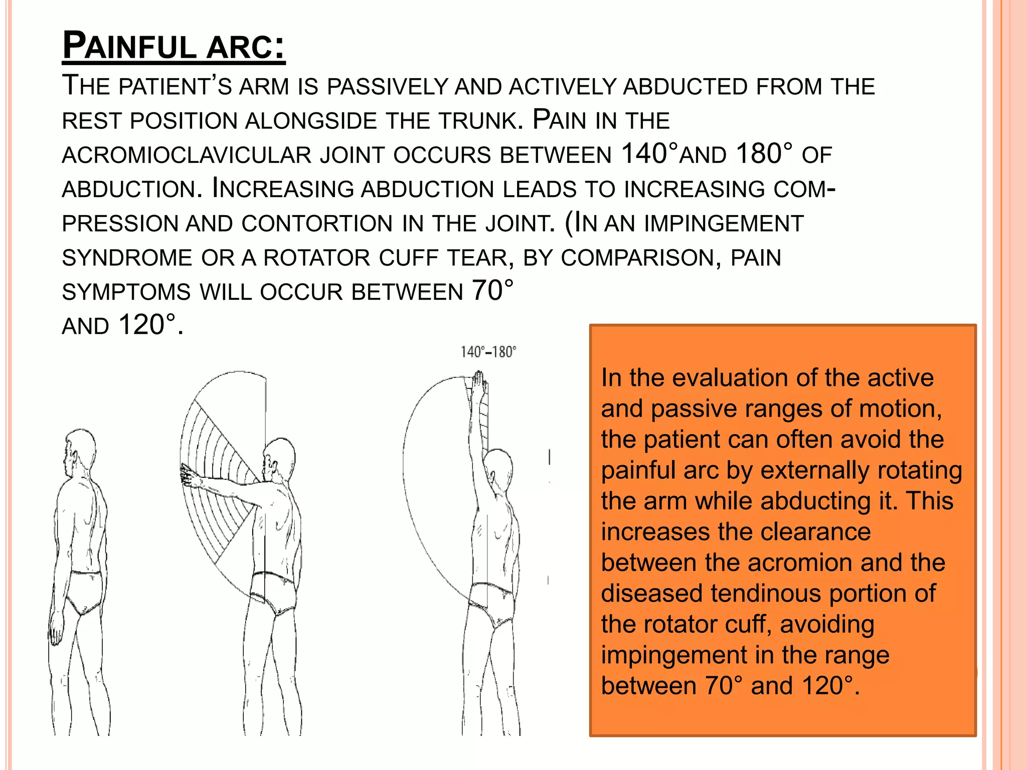 PAINFUL ARC:
THE PATIENT’S ARM IS PASSIVELY AND ACTIVELY ABDUCTED FROM THE
REST POSITION ALONGSIDE THE TRUNK. PAIN IN THE
ACROMIOCLAVICULAR JOINT OCCURS BETWEEN 140°AND 180° OF
ABDUCTION. INCREASING ABDUCTION LEADS TO INCREASING COM-
PRESSION AND CONTORTION IN THE JOINT. (IN AN IMPINGEMENT
SYNDROME OR A ROTATOR CUFF TEAR, BY COMPARISON, PAIN
SYMPTOMS WILL OCCUR BETWEEN 70°
AND 120°.

                                        In the evaluation of the active
                                        and passive ranges of motion,
                                        the patient can often avoid the
                                        painful arc by externally rotating
                                        the arm while abducting it. This
                                        increases the clearance
                                        between the acromion and the
                                        diseased tendinous portion of
                                        the rotator cuff, avoiding
                                        impingement in the range
                                        between 70° and 120°.
 