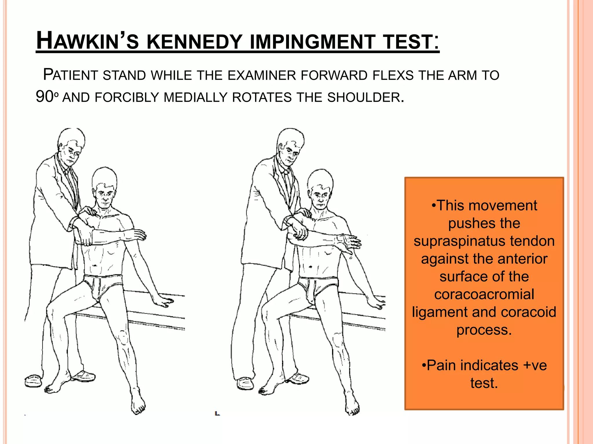 HAWKIN’S KENNEDY IMPINGMENT TEST:
 PATIENT STAND WHILE THE EXAMINER FORWARD FLEXS THE ARM TO
90º AND FORCIBLY MEDIALLY ROTATES THE SHOULDER.




                                                   •This movement
                                                      pushes the
                                                supraspinatus tendon
                                                 against the anterior
                                                     surface of the
                                                    coracoacromial
                                               ligament and coracoid
                                                       process.

                                                •Pain indicates +ve
                                                        test.
 