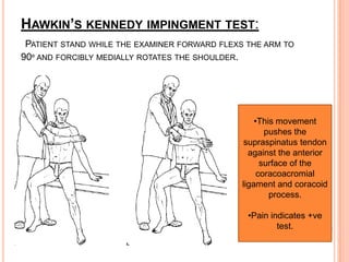 HAWKIN’S KENNEDY IMPINGMENT TEST:
 PATIENT STAND WHILE THE EXAMINER FORWARD FLEXS THE ARM TO
90º AND FORCIBLY MEDIALLY ROTATES THE SHOULDER.




                                                   •This movement
                                                      pushes the
                                                supraspinatus tendon
                                                 against the anterior
                                                     surface of the
                                                    coracoacromial
                                               ligament and coracoid
                                                       process.

                                                •Pain indicates +ve
                                                        test.
 