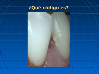9
¿Qué código es?
 