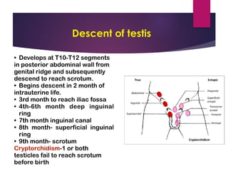 Scrotal Ridge Testicular Ca.pdf