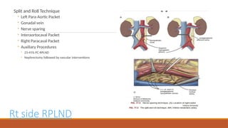 Open Rplnd The surgical and medical management of testicular tumors.pptx
