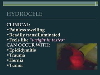 HYDROCELE
CLINICAL:
•Painless swelling
•Readily transilluminated
•Feels like “weight in testes”
CAN OCCUR WITH:
•Epididymitis
•Trauma
•Hernia
•Tumor
 