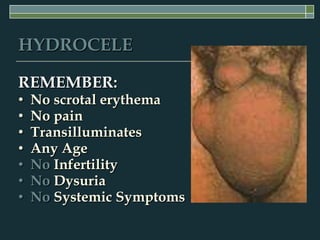 HYDROCELE

REMEMBER:
•   No scrotal erythema
•   No pain
•   Transilluminates
•   Any Age
•   No Infertility
•   No Dysuria
•   No Systemic Symptoms
 