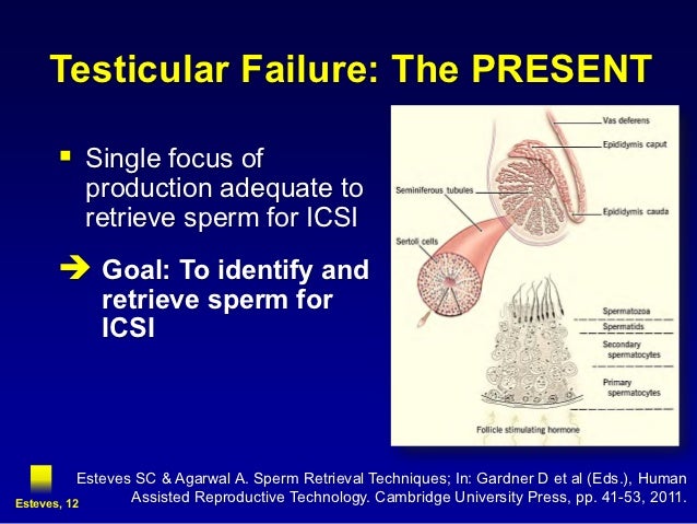 infertile men dating Although men who have cf can enjoy a normal sex life, they are almost always (in about 98% of cases) infertile due to failure of the vas deferens, the tube which carries sperm from the testis to the penis, to develop properly (kaplan et al, 1968)the epididymis sits on top of the testis like a cap. infertile men dating Although men who have cf can enjoy a normal sex life, they are almost always (in about 98% of cases) infertile due to failure of the vas deferens, the tube which carries sperm from the testis to the penis, to develop properly (kaplan et al, 1968)the epididymis sits on top of the testis like a cap.
