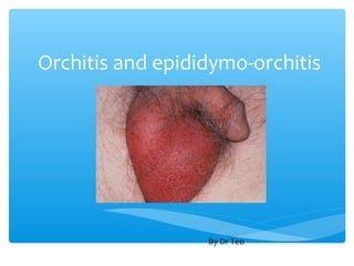 Orchitis and epididymo-orchitis




                  By Dr Teo
 