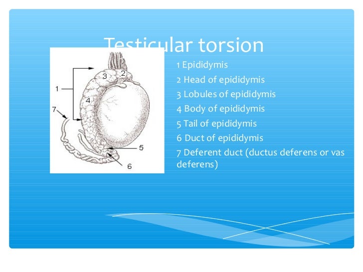 Testicular torsion by Dr Teo