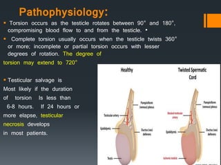 Pathophysiology:
 Torsion occurs as the testicle rotates between 90° and 180°,
compromising blood flow to and from the testicle. •
 Complete torsion usually occurs when the testicle twists 360°
or more; incomplete or partial torsion occurs with lesser
degrees of rotation. The degree of
torsion may extend to 720°
 Testicular salvage is
Most likely if the duration
of torsion Is less than
6-8 hours. If 24 hours or
more elapse, testicular
necrosis develops
in most patients.
 