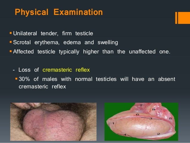 Cpt Code For Manual Detorsion Of Testicle Cpt Code For Manual Detorsion Of Testicle