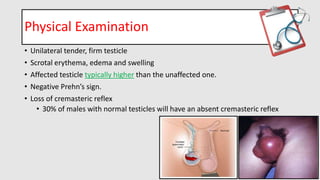 testiculartorsion-190703195435.pdf