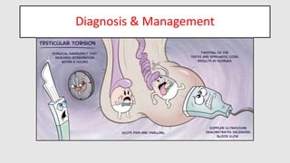 testiculartorsion-190703195435.pdf