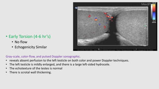 testiculartorsion-190703195435.pdf