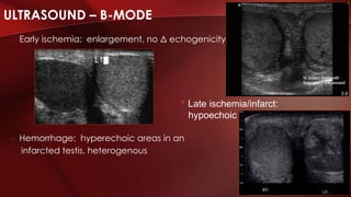 ULTRASOUND – B-MODE
– Early ischemia: enlargement, no Δ echogenicity
– Hemorrhage: hyperechoic areas in an
infarcted testis, heterogenous
• Late ischemia/infarct:
hypoechoic
 