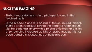 • Static images demonstrate a photopenic area in the
involved testis.
• In the subacute and late phases of torsion (missed torsion),
there is often increased flow to the affected hemiscrotum
via the pudendal artery with a photopenic testis and a rim
of surrounding increased activity on static images. This has
been called a rim, doughnut, or bull's-eye sign.
NUCLEAR IMAGING
 