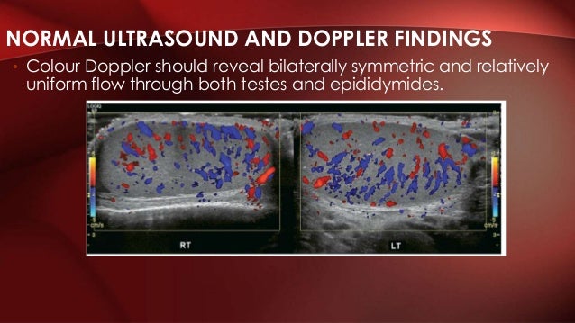 testicular ultrasound