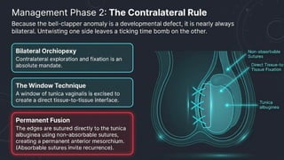 Testicular Torsion (Time is tissue).pptx