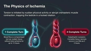 Testicular Torsion (Time is tissue).pptx
