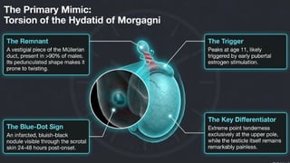 Testicular Torsion (Time is tissue).pptx