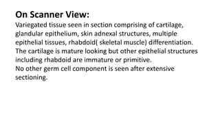 testicular tumor case presentation.pptx