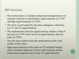 MR IMAGING
 The normal testis is a sharply demarcated homogeneous oval
structure with low to intermediate signal intensity on T1WI
and high signal intensity on T2WI .
 The testis is surrounded by the tunica albuginea, which has
low T1 and T2 signal intensity.
 The mediastinum testis has signal intensity similar to that of
the testis on T1WI and is lower in signal intensity than the
testis on T2WI.
 The rete testis radiates from the mediastinum testis to the
surface of the tunica.
 High signal intensity of the testis on T2-weighted images
allows excellent depiction of focal solid testicular masses,
which most commonly have lower T2 signal intensity.
 