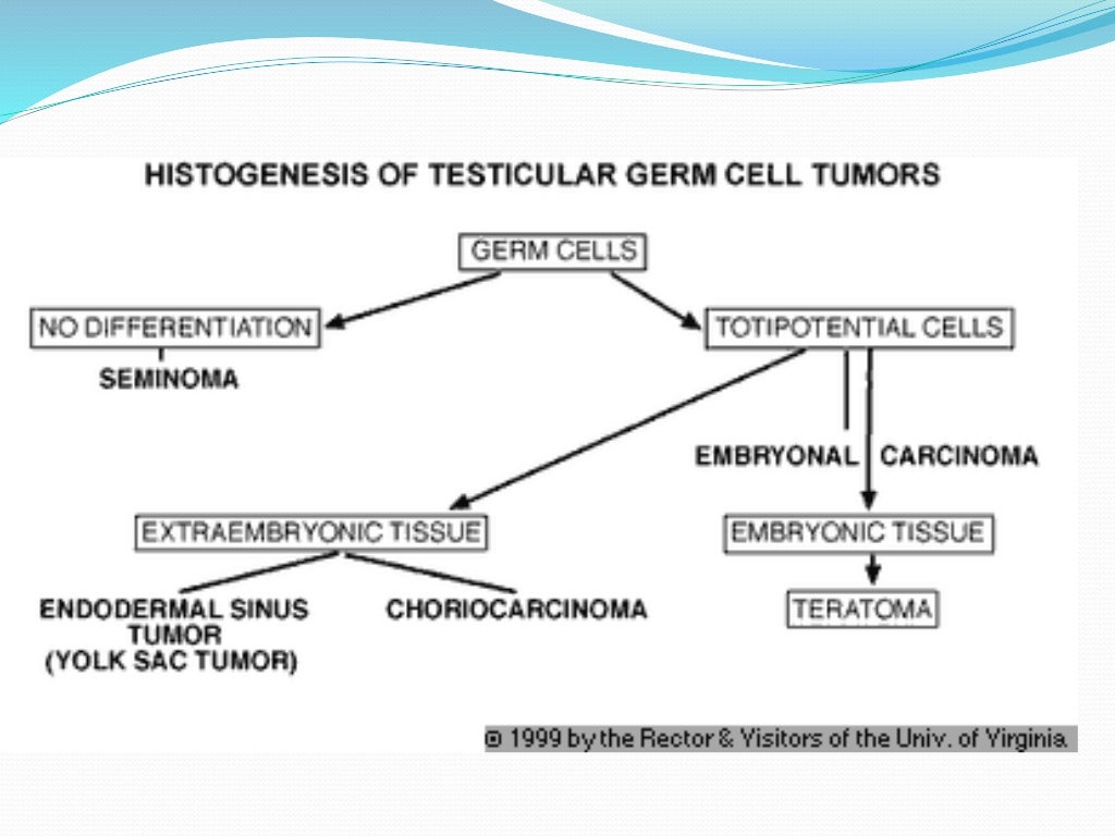 Testicular tumorsCassification, Biomarkers and Staging by Dr Rajesh